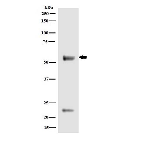 兔抗小鼠Calreticulin （CALR）抗體